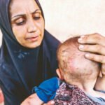 acliktan bebeklerin derisi curuyor AmXibbZa