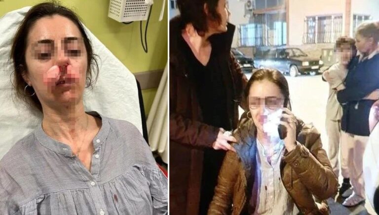 otomobil kapisi silah sayildi esinin sevgilisisandi arabanin kapisiyla saldirdi KTlg5gTU