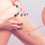 varis vucutta pihti riskini artirabilir mwsbnW3w.jpg