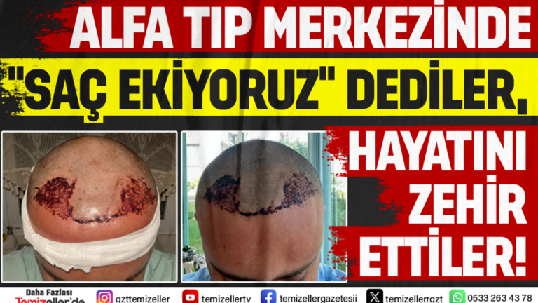 alfa-tip-merkezinde-sac-ekiyoruz-dediler-hayati-zehir-ettiler-cvqfhYvc.png